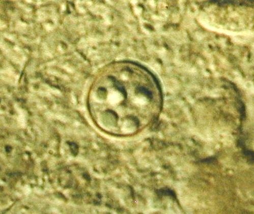 Cyclospora cayetanensis patogenní střevní kokcidie (apicomplexa)