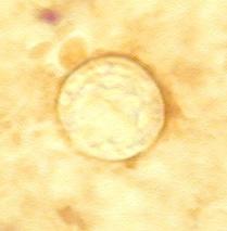 parvum) Cryptosporidium oocysty