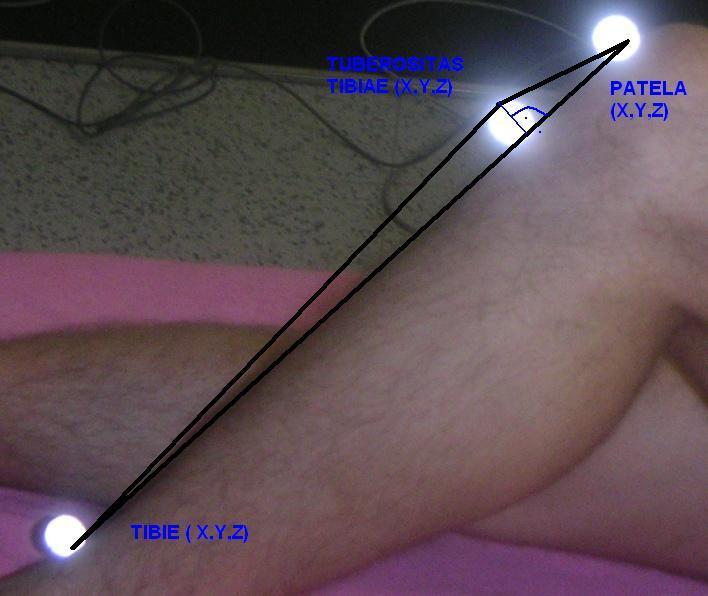 Popis v obr. udělej bíle pro lepší viditelnost Obr. 4-10 Na obrázku jsou reflexní body pospojovány do obecného trojúhelníka.