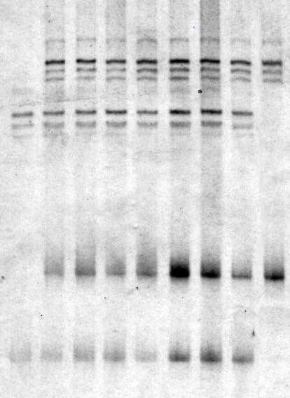 2. Řada vzorků ss DNA (2) 1. Řada vzorků ss DNA (1) ds DNA (2) ds DNA (1) Obr.16 SSCP analýza vzorků na mutace v exonu č.