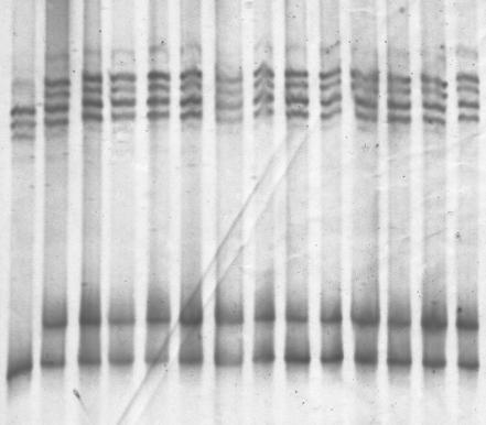 1. Řada vzorků 2. Řada vzorků ss DNA (2) ss DNA (1) ds DNA (2) ds DNA (1) Obr.17 SSCP analýza vzorků na mutace v exonu č.