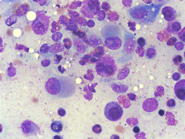 Cytologická diagnóza: mastocytom grade II III. Histologická diagnóza: mastocytom grade II. MayGrünwald/Giemsa, 250x Obr.