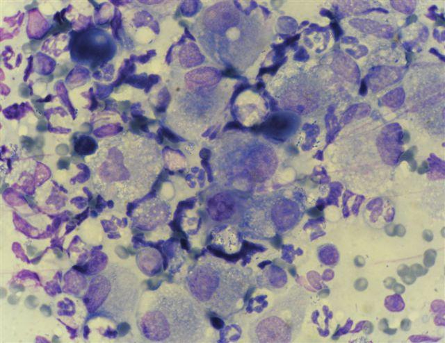 Histologická diagnóza: SCC. MayGrünwald/Giemsa, 100x. Obr. 20: FNAB z útvaru v tlamě (kočka; kocour; 13 let).