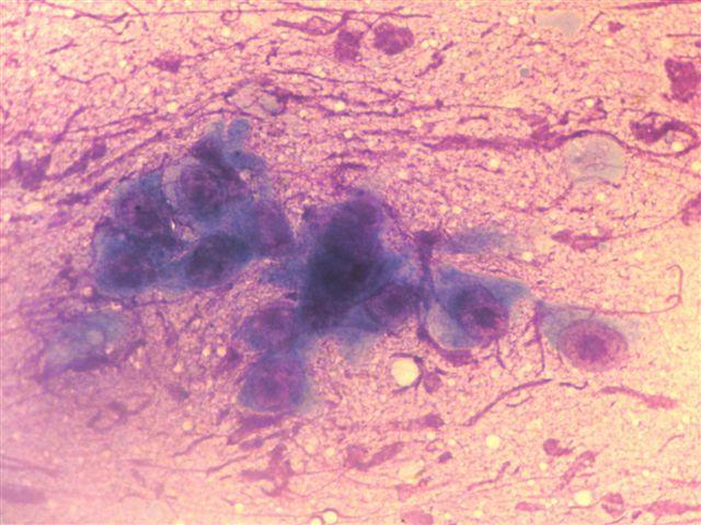 Histologická diagnóza: MU bez nálezu. MayGrünwald/Giemsa, 250x. Obr. 22: FNAB z útvaru na krku (pes; fena; 8 let; mastin).