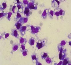 Cytologická diagnóza: stav po zánětlivém procesu, histologická diagnóza: hyperémie. MayGrünwald/Giemsa, 250x Obr.