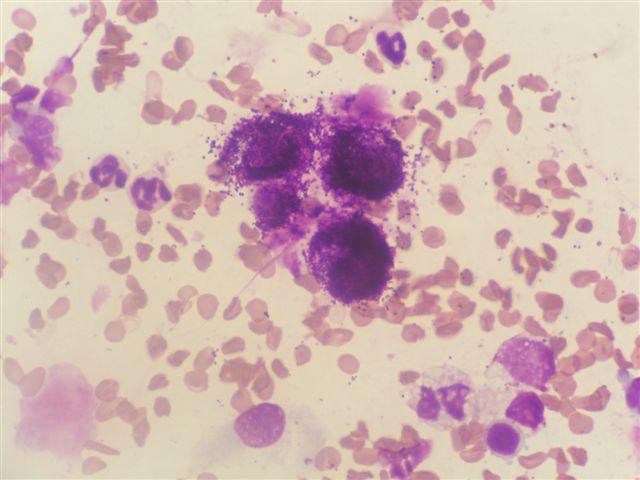 Cytologická diagnóza: mastocytom grade II. Histologická diagnóza: mastocytom grade II. MayGrünwald/Giemsa, 250x Obr. 4: FNAB z útvaru na stehně (pes; samec; 9 let; německý boxer).