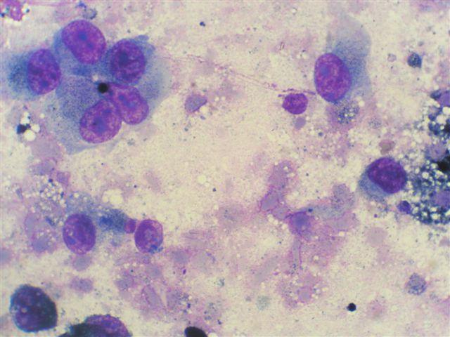 Jednalo se o psa s útvarem v dutině ústní, který byl diagnostikován jako melanom. Cytologická diagnóza: maligní melanom.