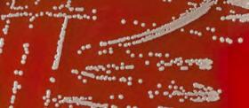 SS Salmonella enteritidis SCH Bacteroides fragilis SS Shigella flexneri PEVNÁ MEDIA Zkratka Název Účel použití Klasifikace Plnění SBA SC SCH SCHCNA SCHKV