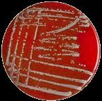 indole motility) medium Salmonella Shigella agar Chromogenní Strepto B agar izolace, detekce a určení počtu enterokoků ve vzorku pomocí membránové filtrace