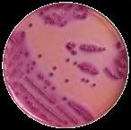 ve vzorku izolace, detekce a určení počtu koliformních bakterií ve vzorku diagnostická selektivně-diagnostická, PM55 ZK, OP, L, L