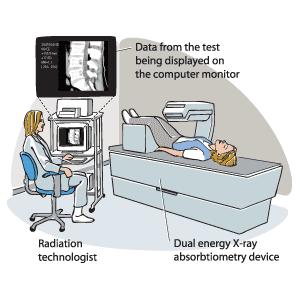 Obrázek 2. Schéma měření DEXA (upraveno dle http://ziim.us/articles/dexa-scansfor-osteoporosis-and-body-mass-composition.