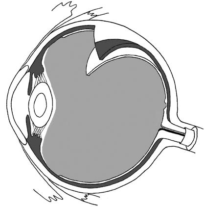 Oko a jeho ochranné a přídatné části 2 horní přímý sval řasnaté těleso pars plana pars plicata skléra cévnatka sítnice duhovka rohovka přední komora zadní komora limbus corneae čočka optická osa