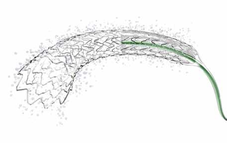 Coroflex ISAR Nejnovější generace DES Sirolimus uvolňující bezpolymerový koronární stent Abluminální krytí bezpolymerovou