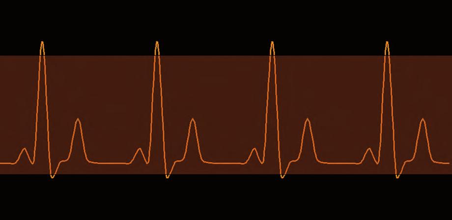 3 Retrospektivní gating Vyšetření metodou retrospektivního EKG gatingu, tedy s kontinuálním záznamem dat v průběhu celého srdečního cyklu, bylo technicky možné již na spirálních jednodetektorových