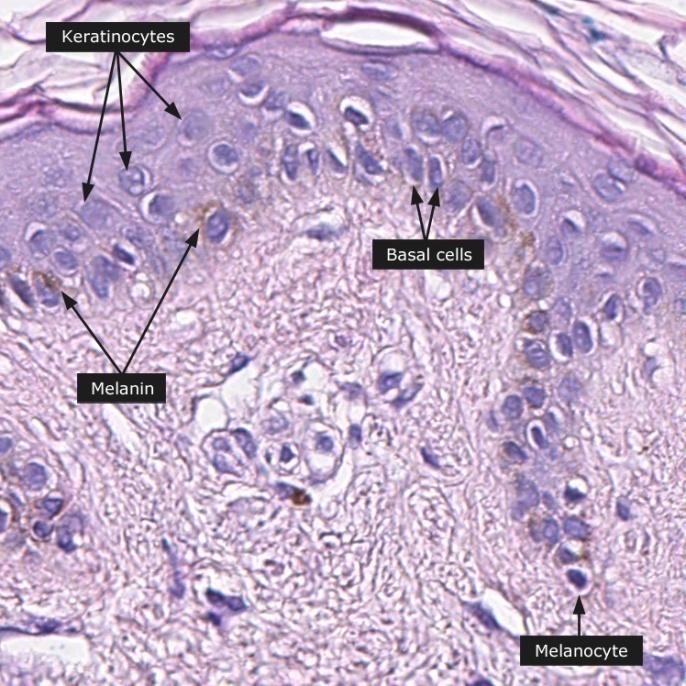 3. 1. 2 SYNTÉZA MELANINU SAVCŮ 3.1.2.1. MELANOCYTY Syntéza melaninu se odehrává ve specializovaných bupkách zvaných melanocyty. Ze sférické bupky melanocytu nepravidelně vybíhají dlouhé výběžky.