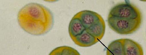 Mikrosporogeneze Meiosa Oddělená