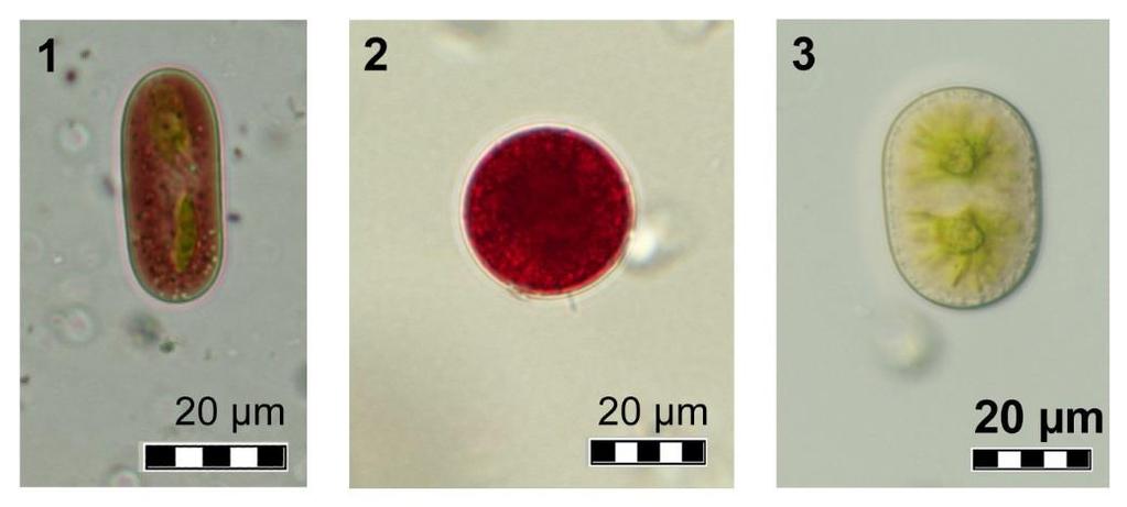 MIKROBIOLOGIE - ALGOLOGIE Obr. 4.15. Typičtí zástupci mikroflóry sněžných a ledových řas.