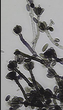 Phomopsin A Producent: Phomopsis leptostromiformis (tel.