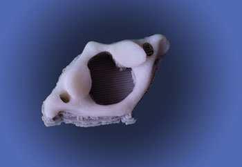 :2-25) 3D model krčního