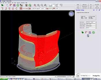 :2-27) Model komponenty kolenního kloubu [24] Pro další zpracování je CAD model exportován ve formě STL dat.