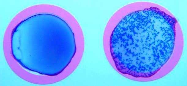 Saccharomyces cerevisiae, h - Candida parapsilosis 2.1.3. Sérologické metody Sérologická identifikace kvasinkových kultur je založena na principu latexové aglutinace.