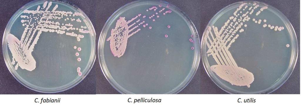 49 Při kultivaci na chromogenním agaru COLOREX Candida za teploty 37 C byly po 48 h zjištěny mezi uvedenými druhy kvasinek určité rozdíly v barvě kolonií. C. fabianii měla růžové, obklopené světlejším dvorcem, C.