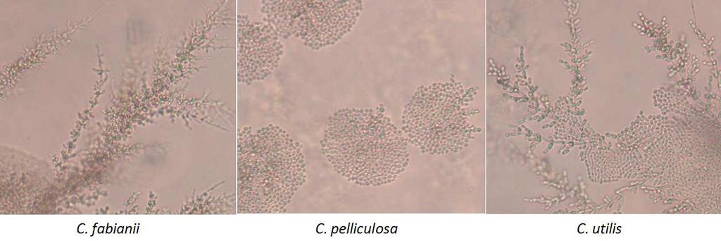 8: Kultury Candida fabianii, Candida pelliculosa a Candida utilis na chromogenní půdě po 48 h/37 C Výsledky porovnání mikroskopického vzhledu jednotlivých druhů kvasinek na rýžovém agaru jsou
