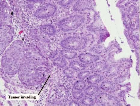 HCT116 Colorectal cancer Derived from adult male Commonly used to study