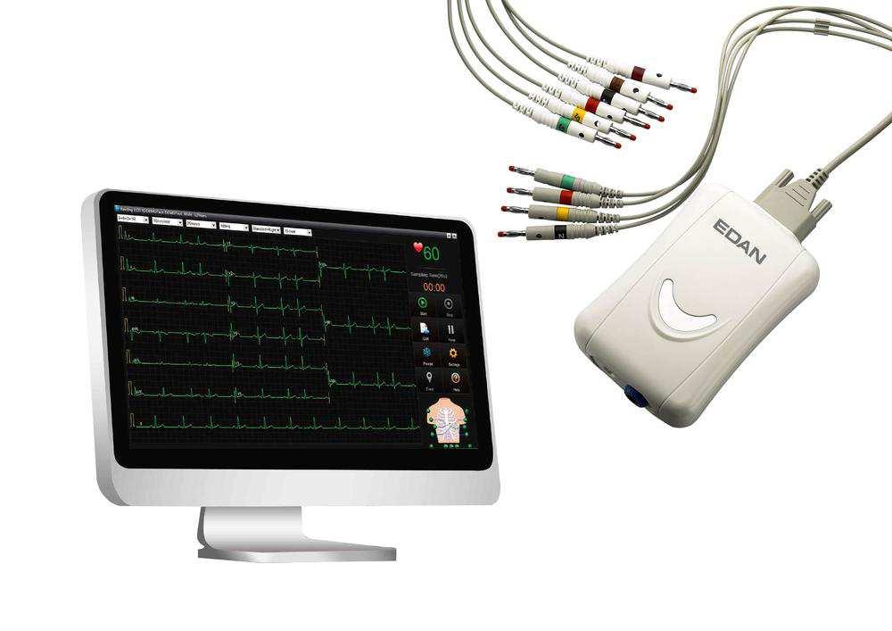 síťový a bateriový provoz (Li-ion baterie) rozhraní RS-232, USB, Ethernetový výstup hmotnost: 3 kg (včetně baterie) přístroj, EKG kabel, hrudní elektrody, končetinové elektrody, akumulátor,