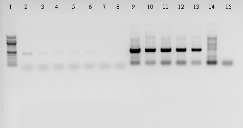 4.6 Ověření transformace regenerovaných rostlin Pro ověření, zda- li proběhla transgenoze správně byla provedena po izolaci DNA z transformovaných tabáků PCR reakce pro identifikaci vnesených oblastí