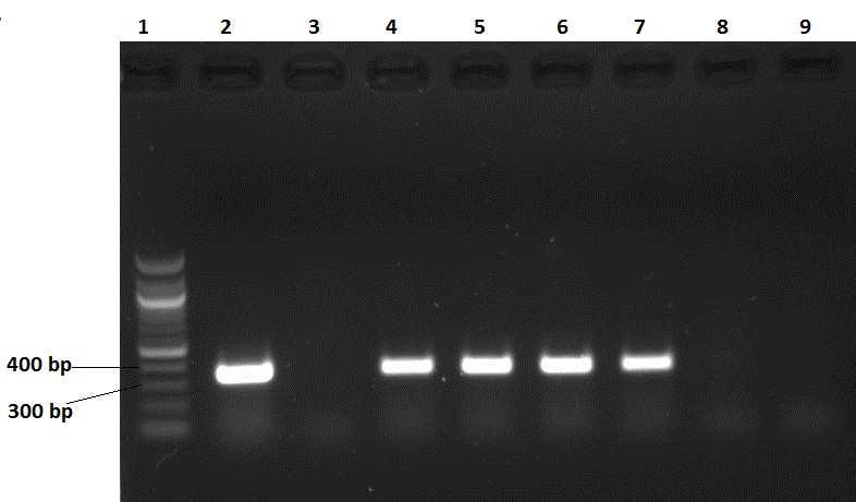 Takto získaný plazmid pwell14 byl následně purifikován. Purifikace slouží k čištění DNA, tzn.