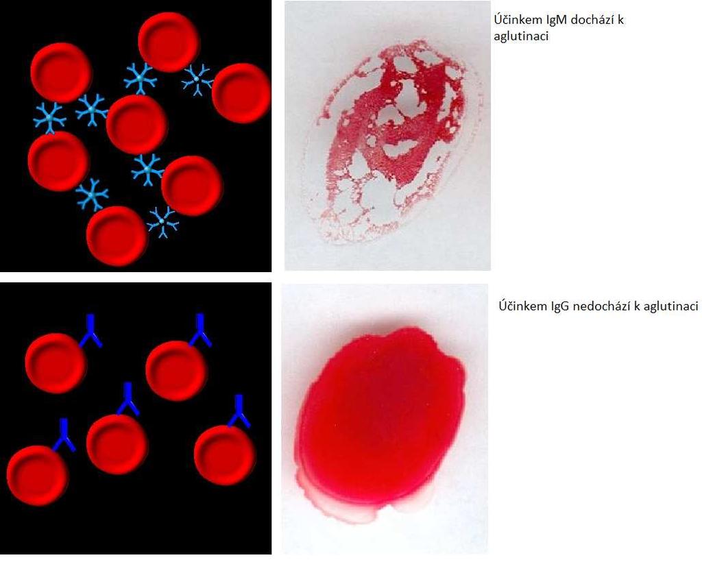 erytrocyty. IgG molekula je malá k přemostění vzdálenosti mezi jednotlivými erytrocyty.