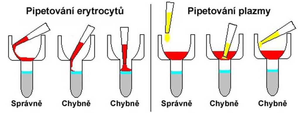 Obr. 8: Zásady správného pipetování (Dostupné z:http://www.eurexmedica.cz/files/0000000043.pdf) Obr.