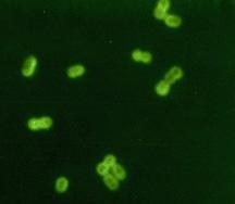 fluorescenční mikroskopie Princip spočívá ve vazbě fluorochromového barviva na