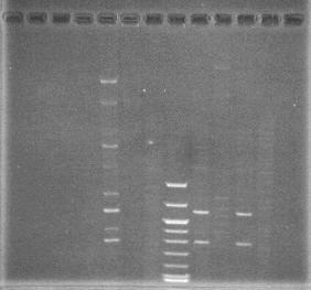Restrikční analýza plazmidové DNA RE - sekvenčně specifická nukleáza,