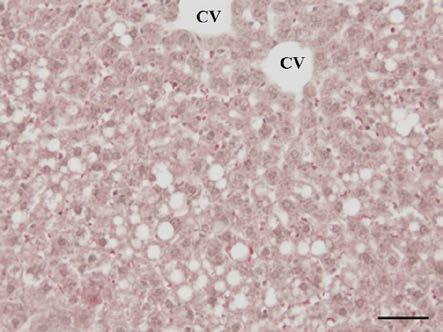 7. VÝSLEDKY 7.1 Výsledky pokusů in vivo 7.1.1 Zavedení modelu nealkoholového ztukovatění jater potkana in vivo Podávání MFD and HFD u potkanů kmene Wistar, resp.