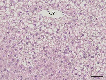 Jaterní steatóza byla potvrzena i stanovením obsahu TAG v játrech těchto potkanů a rovněž pomocí speciálního histologického barvení na tuky ve zmražených preparátech (obr. 2).