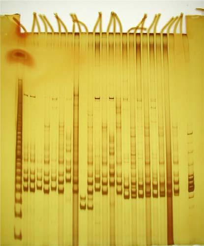 Laboratoř molekulární genetiky rostlin Postup 1) Výběr originálních a výkonných zdrojů rezistence k padlí - Hordeum vulgare ssp.