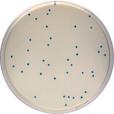 4.4.3 Stanovení počtu enterokoků Pro stanovení počtu enterokoků byla použita půda COMPASS Enterococcus Agar (NOACK, Francie).