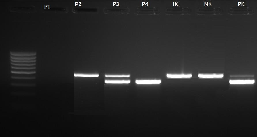 Úkol 3a: Detekce PCR produktu IC vlastní reakce Pacienti P3 a P4 pozitivní, pacient P2 negativní, pacient