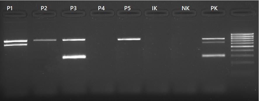 Úkol 3b: Specifická detekce PCR produktu gelovou elektroforézou Sta Fem MecA Podobné jako předchozí, ale paralelní