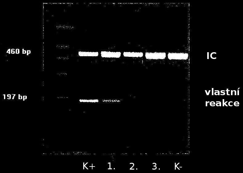 Úkol 4a: PCR nukleové