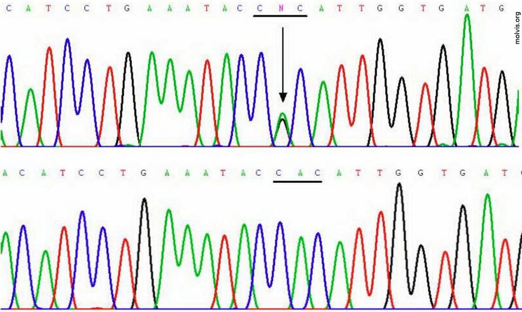 Vzorek pro sekvenování vzorek do laboratoře izolace DNA amplifikace DNA