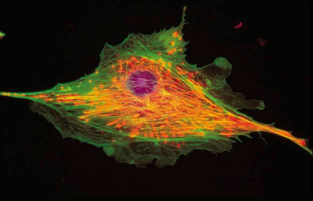 Multicolor Detection: Image Stain Target Color DAPI Nucleii Blue BODIPY