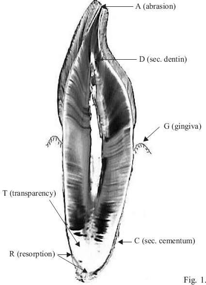 DOSPĚLÝ - DENTICE histologie zubních tkání jednokořenových zubů předpokladem zubní výbrus nebo nábrus destruktivní metoda morfoskopické a morfometrické znaky