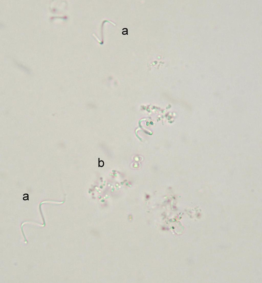 Obrázek č. 2 - a) stočená vlákna (pravděpodobně sinic rodu Planktolyngbya) b) nepravidelné shluky koloniálních sinic (pravděpodobně Aphanocapsa sp.), rybník Cikán, Hradec Králové (vzorek odebraný 5.