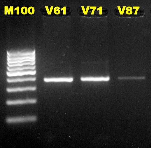 objemu (50 µl). Poměrné množství DNA v reakční směsi byl zachováno, byla pouze upravena teplota annealingu na 64 C po dobu 30 s.