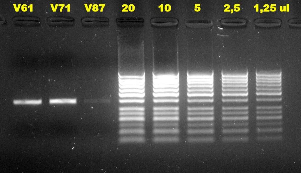 1031 bp 400 bp Obr.