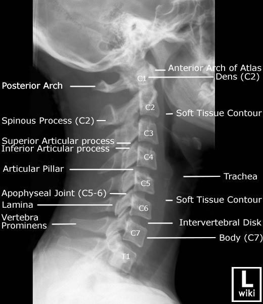 com/vertebral-column-2 Obrázek 54 Snímek krční páteře