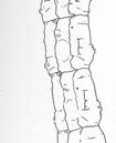 ? Crowsoniellidae) - hlava a pronotum s tykadlovými rýhami - krovky s mřížovitou m